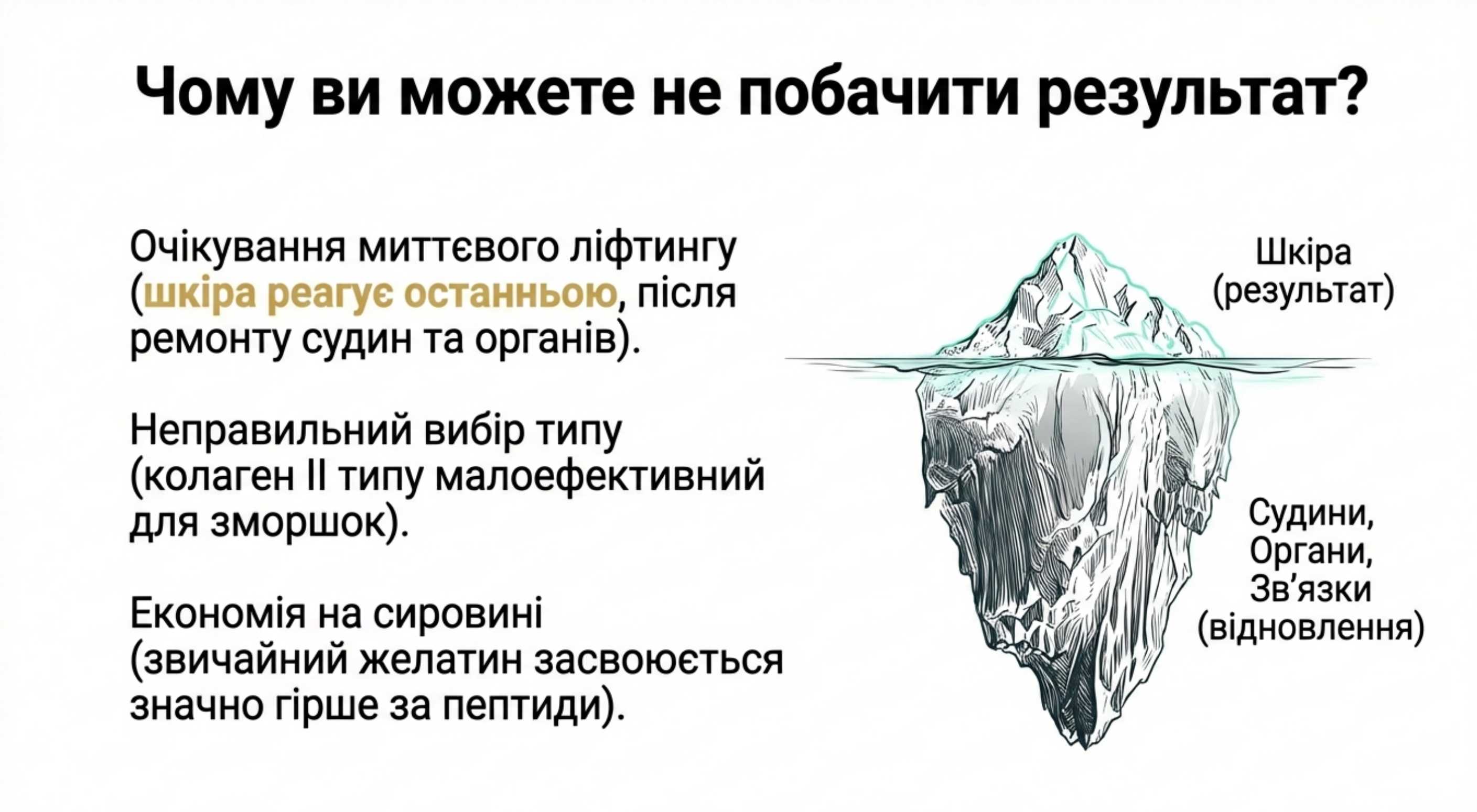 Висновок. Інвестиція в структурну молодість