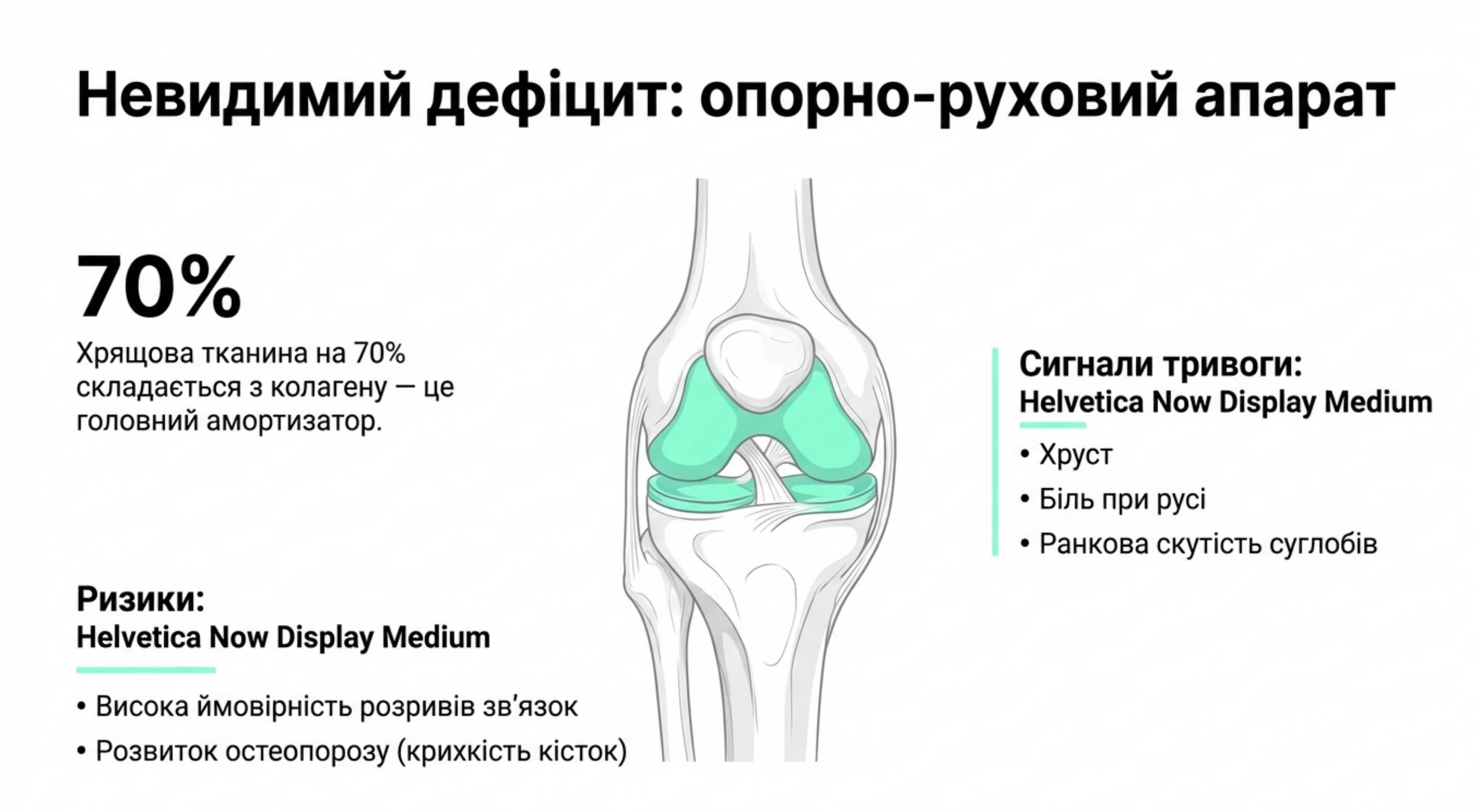 Опорно-руховий апарат