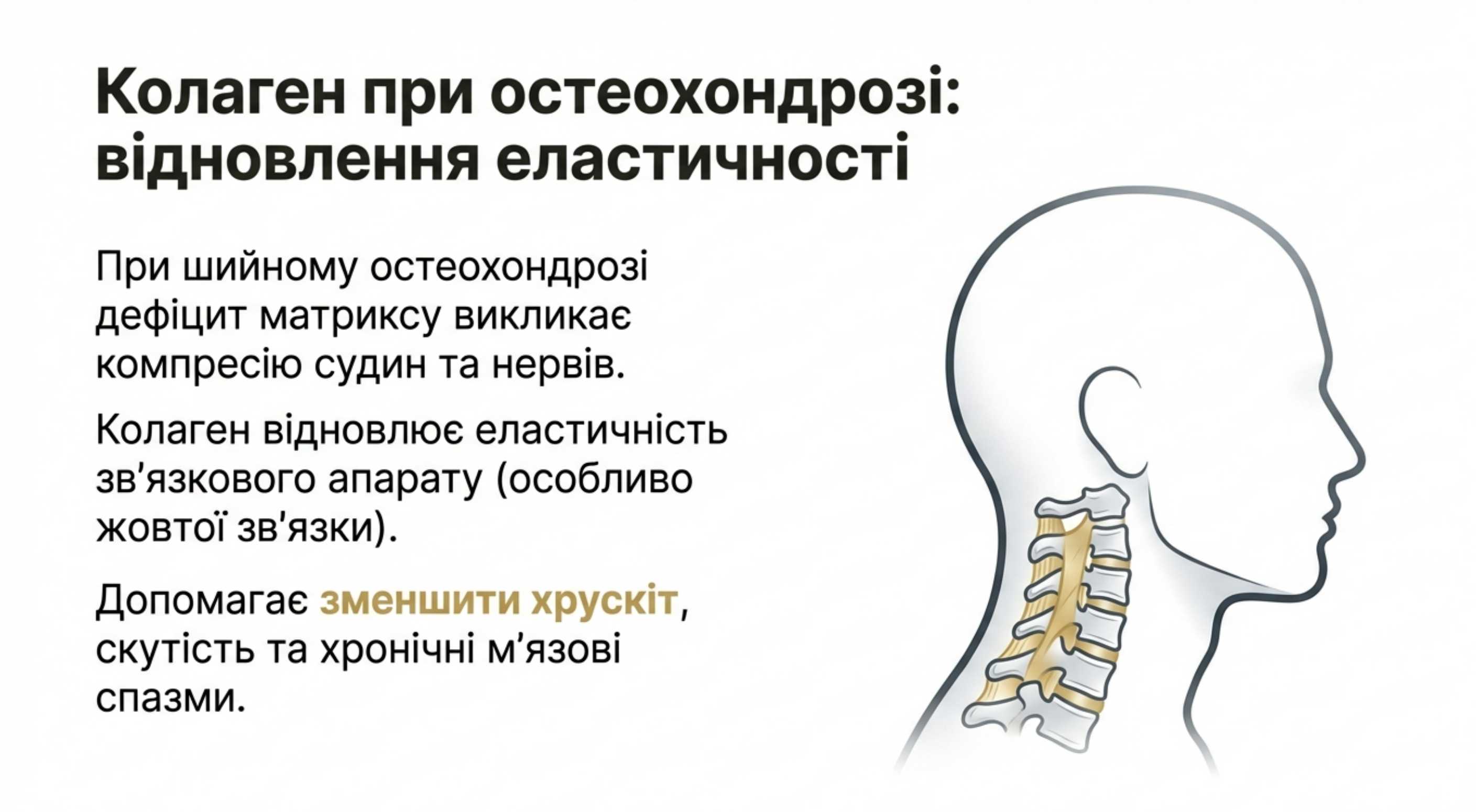 Коллаген при шийному остеохондрозі