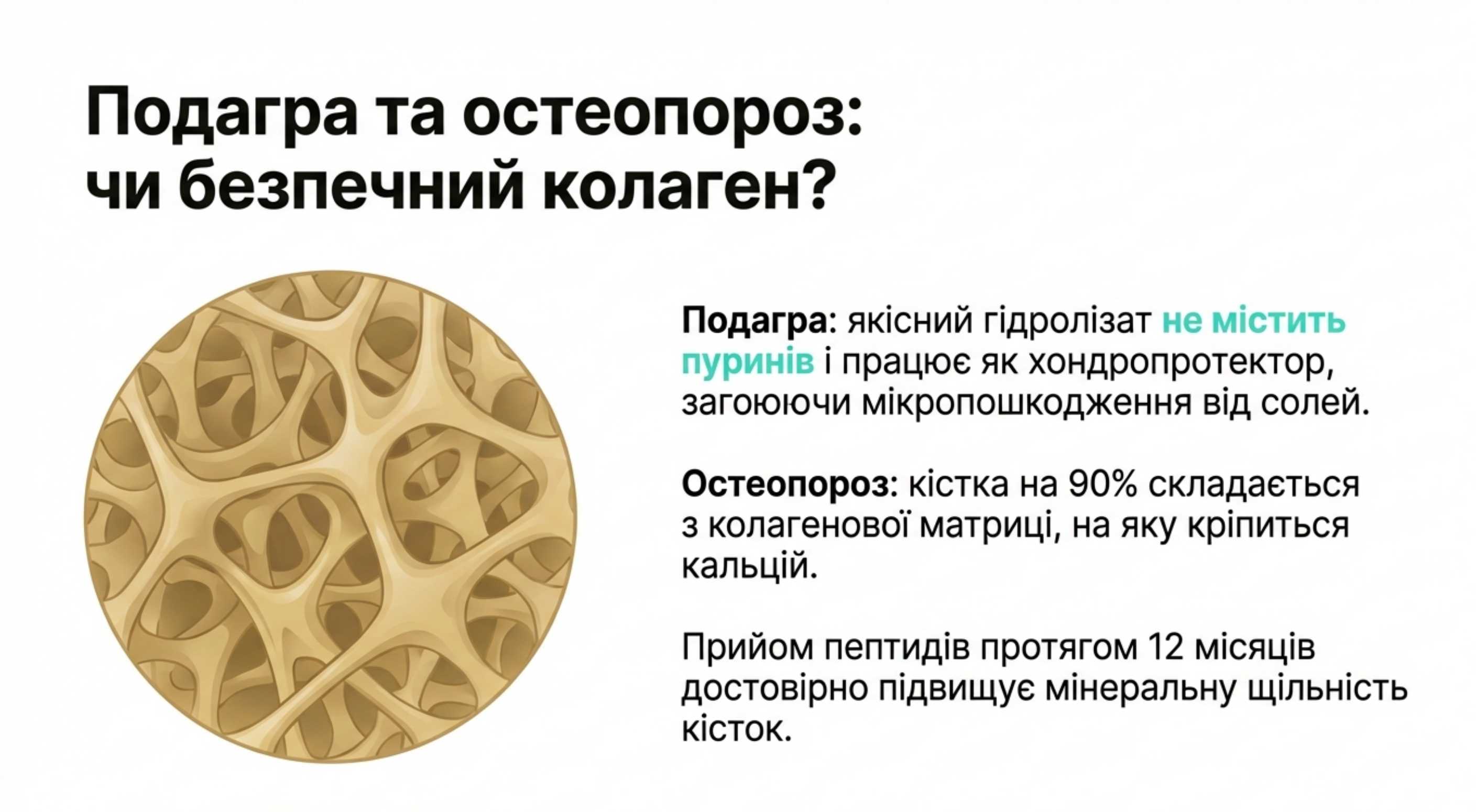Коллаген і метаболічні порушення. Подагра та остеопороз