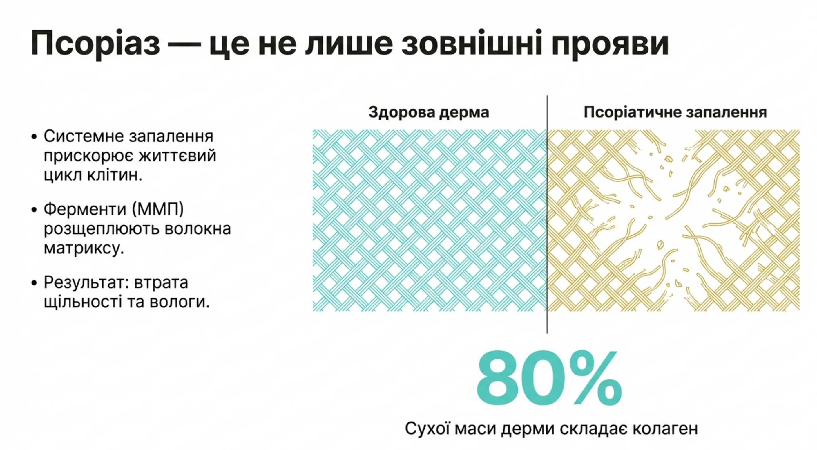 Коллаген і псоріаз. Фізіологічний зв'язок і суть проблеми