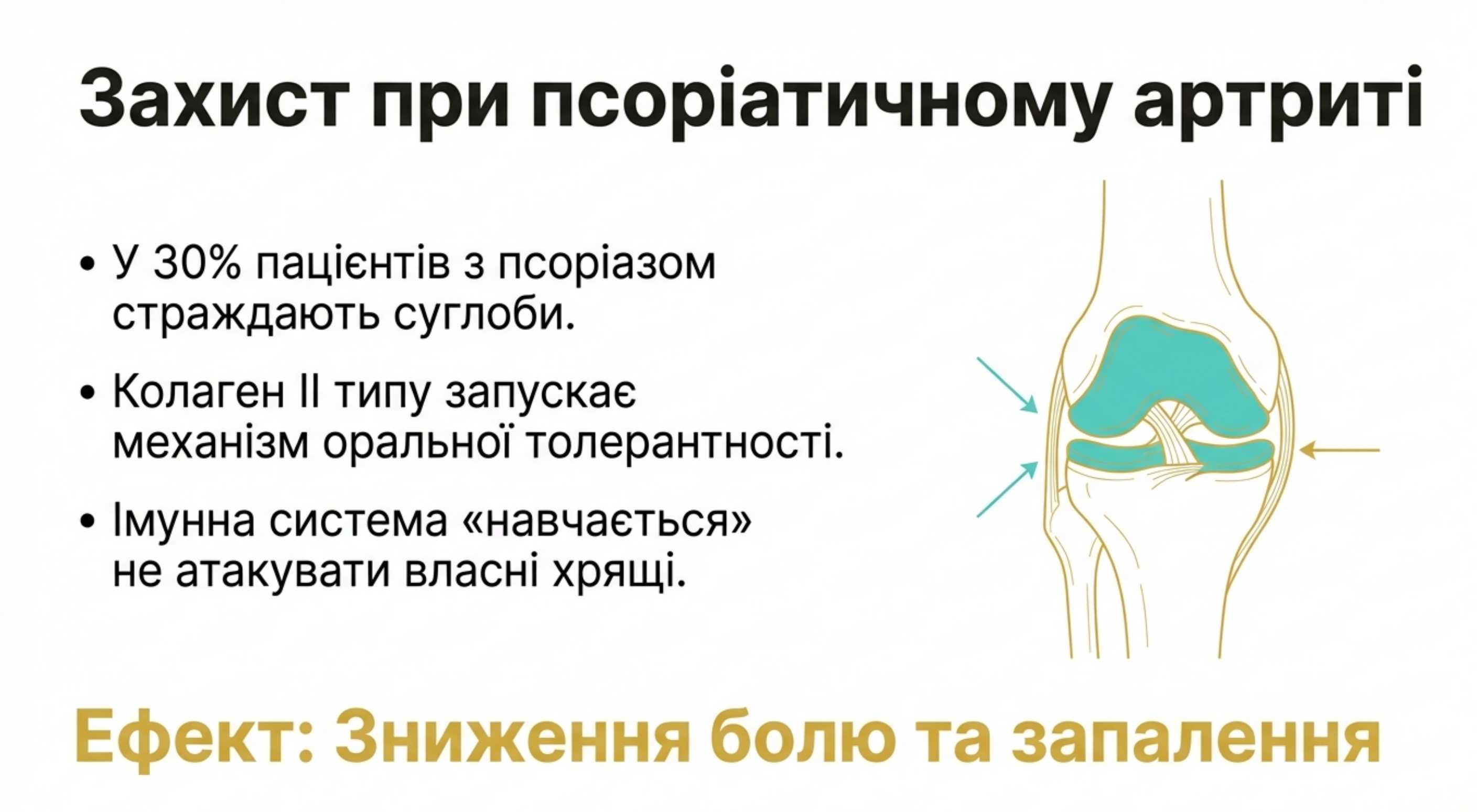 Системне запалення і псоріатичний артрит