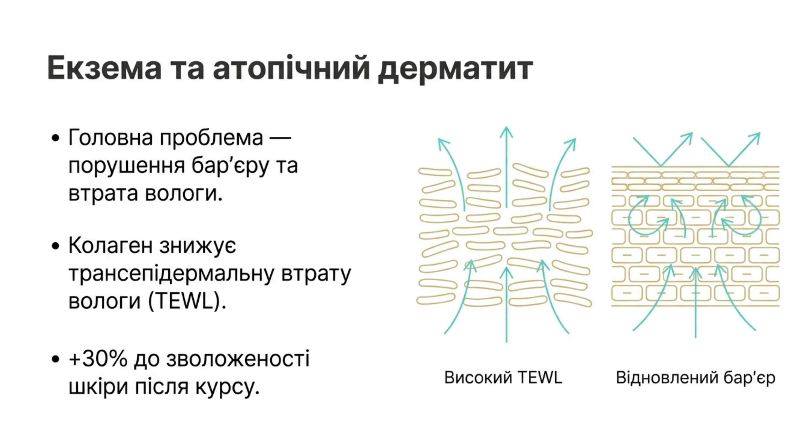 Коллаген при екземі. Механізми відновлення епідермального бар'єра