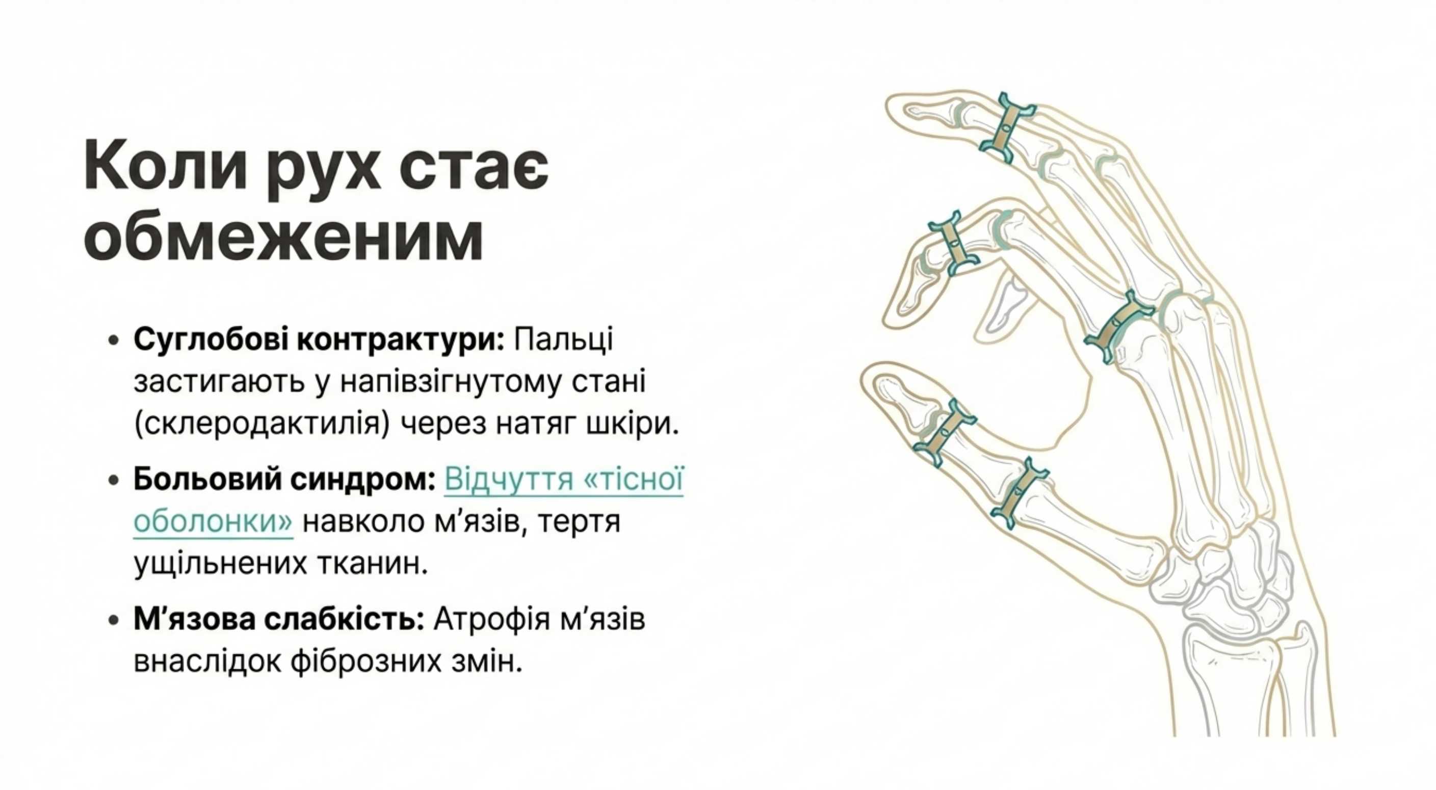 2. Опорно-руховий апарат