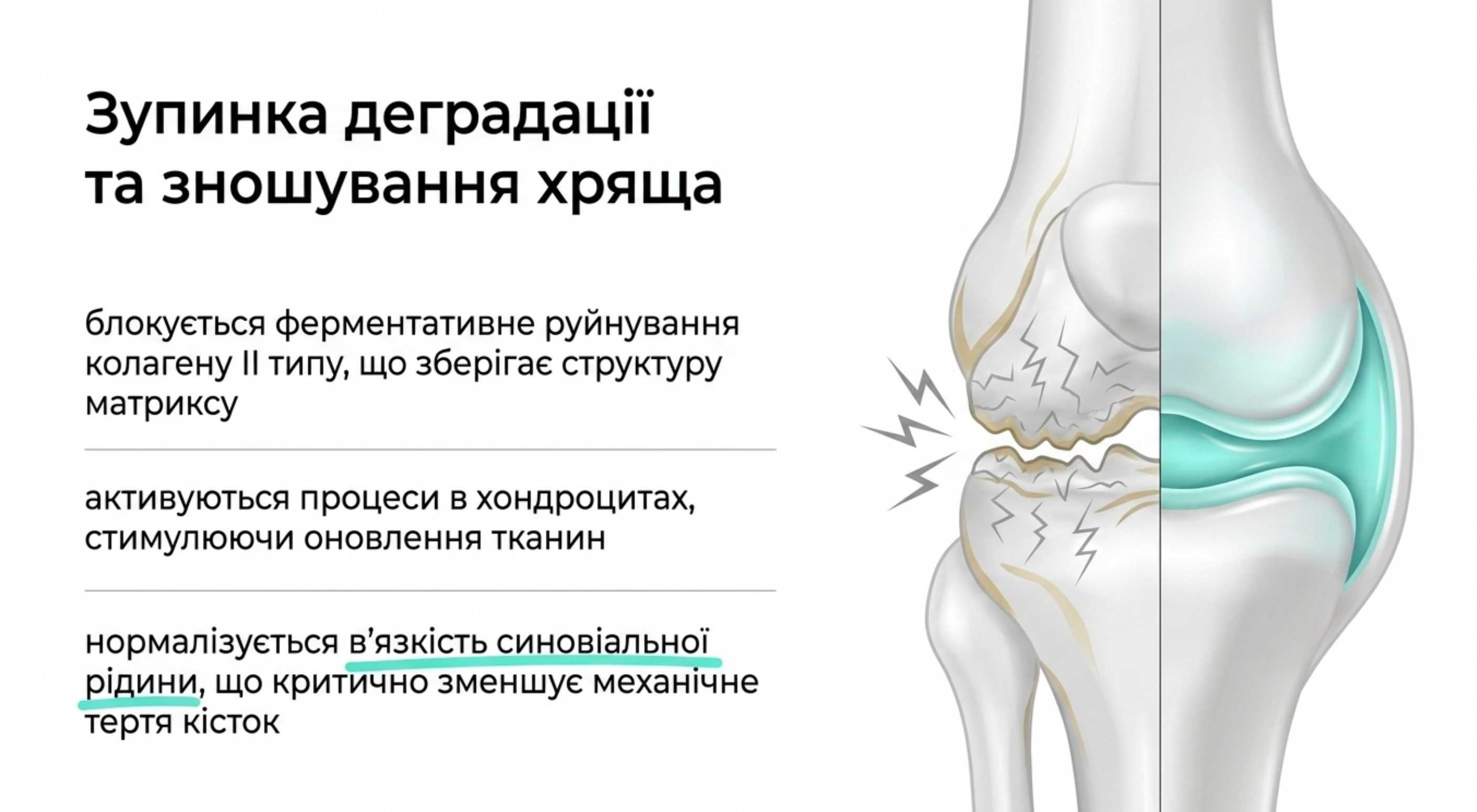 Защита хрящевой ткани и синовиальной жидкости. Омега 3 при артрозе
